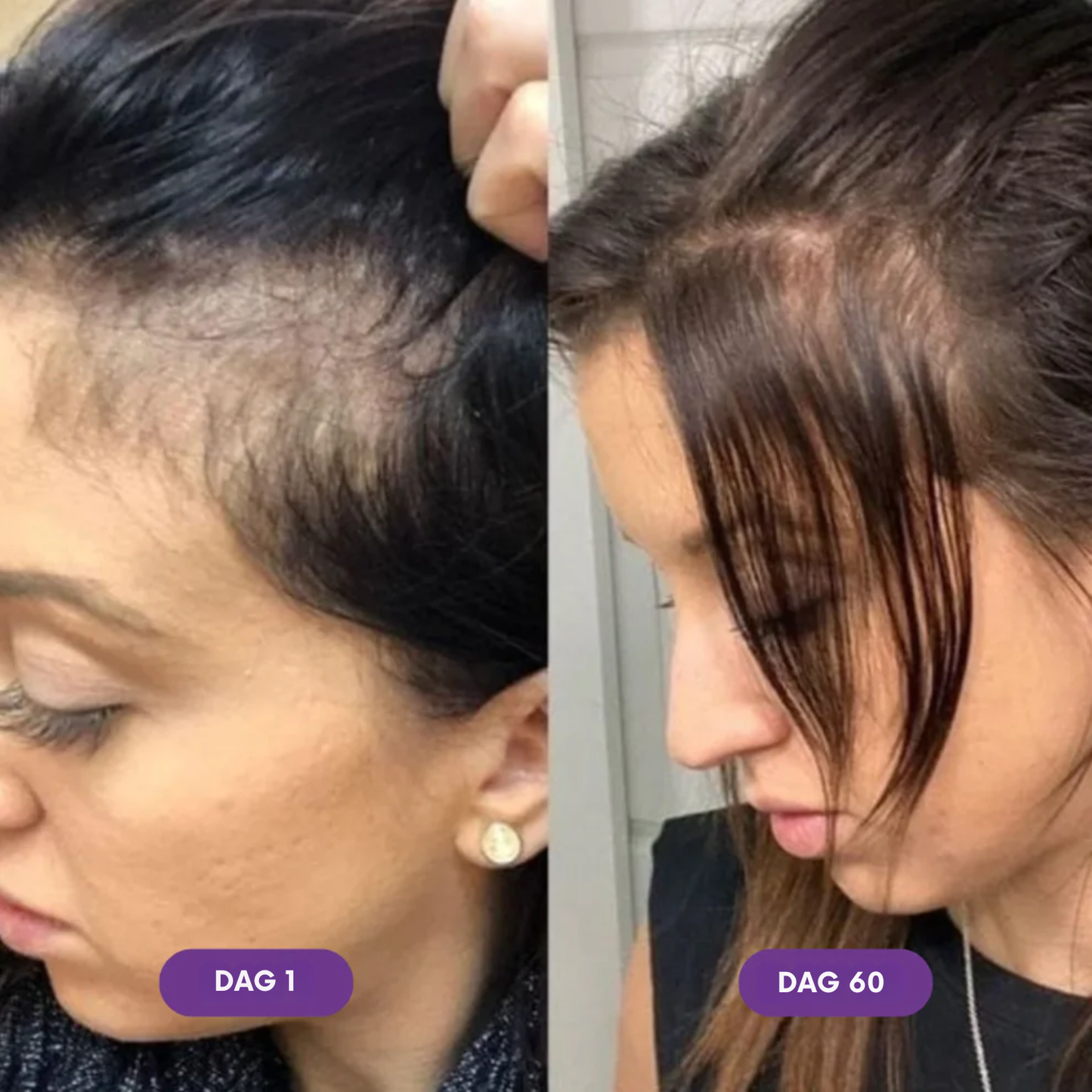 Force Factor - Hair Accelerator Chews