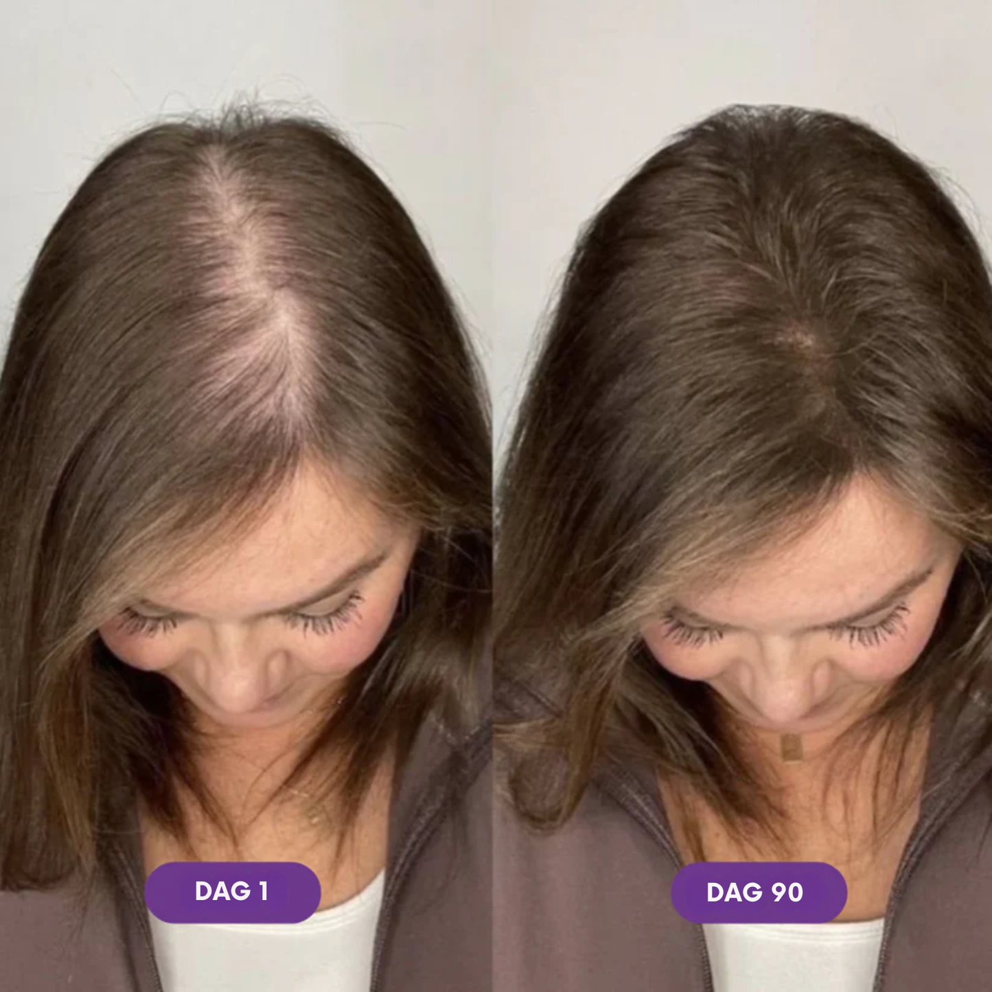 Force Factor - Hair Accelerator Chews