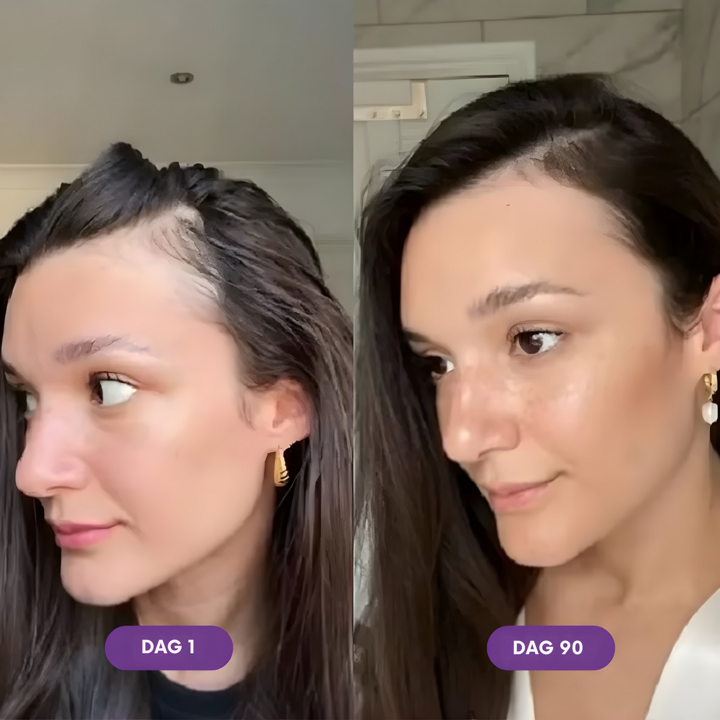 Force Factor - Hair Accelerator Chews